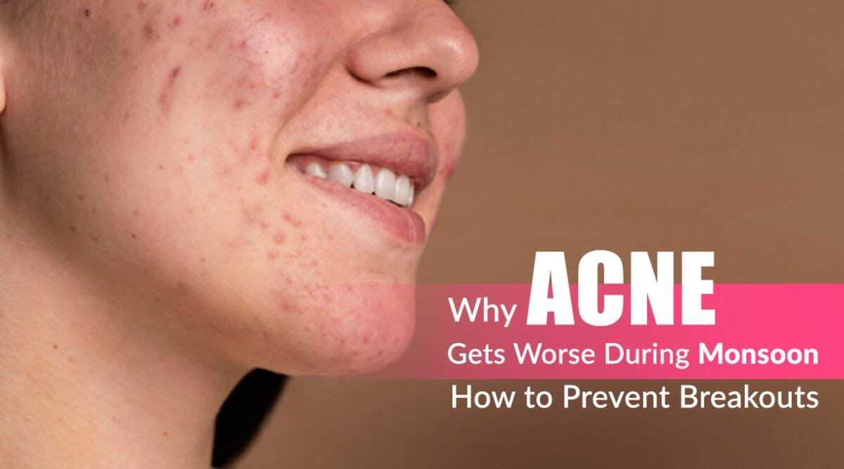 Monsoon Acne, Rainy Season Breakouts, Acne Prevention Tips, Clogged Pores Humidity, Dermapuritys, Oily Skin Monsoon Care, Acne Treatment